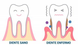 dientes_niños2