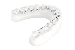 invisalign