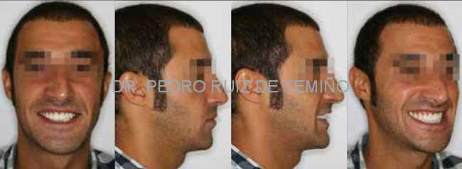 Conclusiones